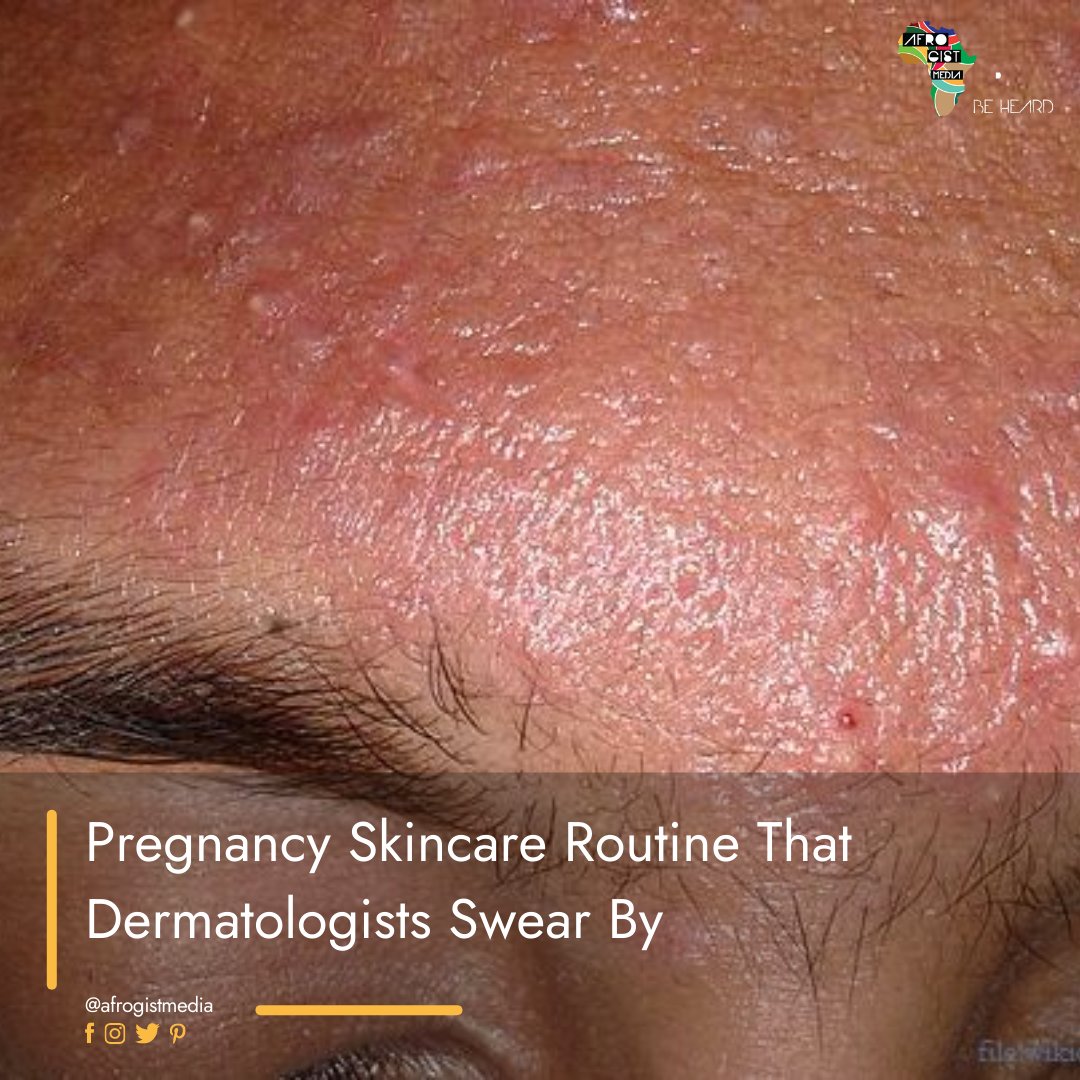 #Pregnancyskincare routine for everyone- Pregnancy comes along with lots of changes, and some happen to your skin. Immediately you realize you are pregnant; you need to review your beauty products and adjust your skincare regime.
Read more - bit.ly/3zWJl7l
#pregnancy