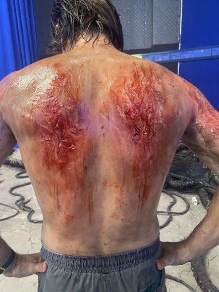 spcecdets's tweet photo. be fucking fr rn these were just his arm and back scars and he was sticking the landing off bed sheets into the upside down hours later 😭😭 ???? nuh uh lmaoooooo https://t.co/49XOCw7S5z