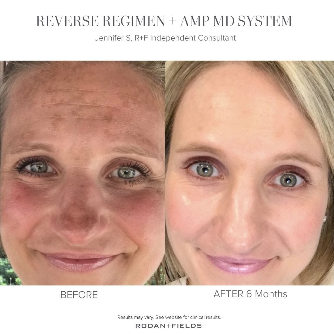 MedeiJen's tweet photo. Are you ready to reverse sun damage? 

#rodanandfields #skincare #lashes #brows #hydration #serum #acne #aging #sensitiveskin #sundamage #SPF https://t.co/n52JUuatIC