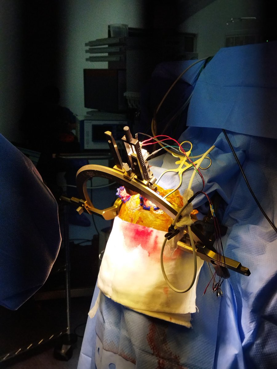 Marisoldadin's tweet photo. Cirugía con paciente despierto y la crush. 😌💂
#NeuroTeam #Neurosurgery https://t.co/iZhXSrn1aQ