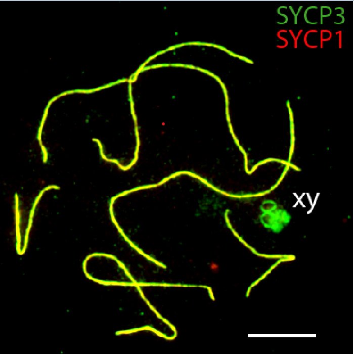 A_RuizHerrera's tweet photo. Don't miss @L_MarinGual talk tomorrow (North Hall, 16:15) on meiotic sex chromosome dynamics in marsupials
S02 symposium #SexChromosomeEvolution organized by @WenJuanMa84 &amp; @MRovatsos
 #ESEB2022 https://t.co/jnXMCJEtWU