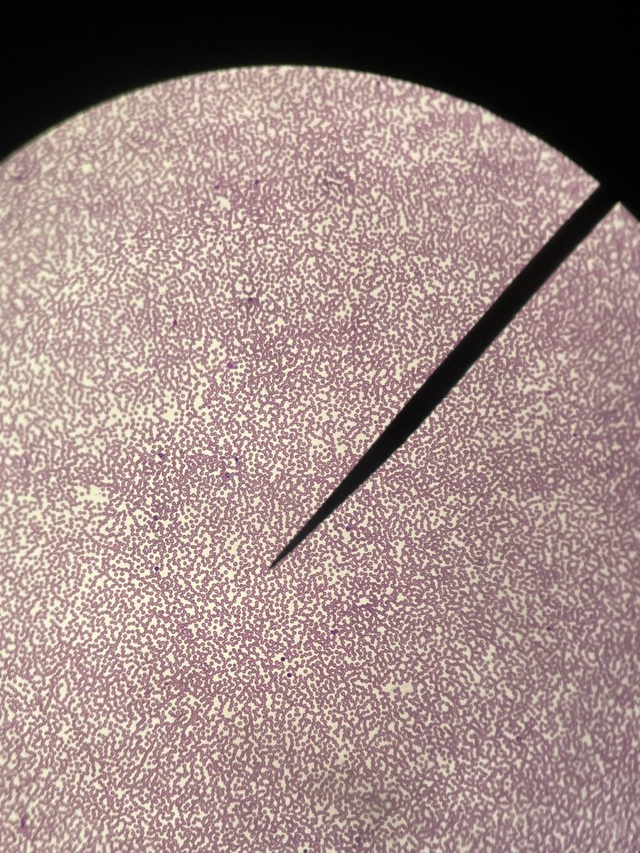 เม้ดเลือดขาวน่ารักที่สุดเลอ 😭🤲🏻🫶🏻🫶🏻