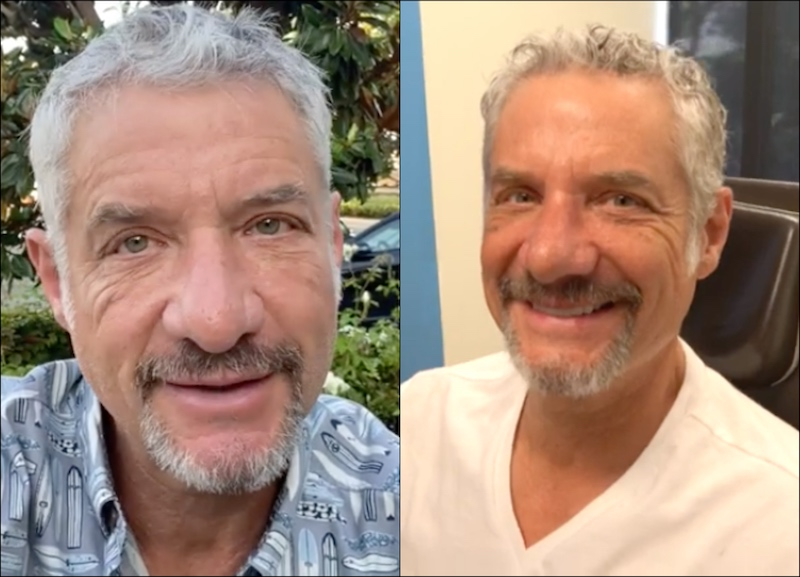BrightlyAgain's tweet photo. PHOTOS: 'RHOC' Alum Kelly Dodd’s Husband Rick Leventhal Reveals Nose Job, See His Before and After Pics as Kelly Announces New Podcast With Vicki Gunvalson! #RHOC #KellyDodd #RickLeventhal #VickiGunvalson https://t.co/c81AjGRbT1 https://t.co/9GwaPeluOL