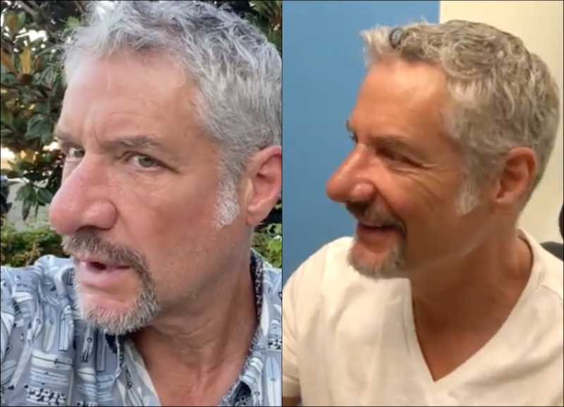 BrightlyAgain's tweet photo. PHOTOS: 'RHOC' Alum Kelly Dodd’s Husband Rick Leventhal Reveals Nose Job, See His Before and After Pics as Kelly Announces New Podcast With Vicki Gunvalson! #RHOC #KellyDodd #RickLeventhal #VickiGunvalson https://t.co/c81AjGRbT1 https://t.co/9GwaPeluOL