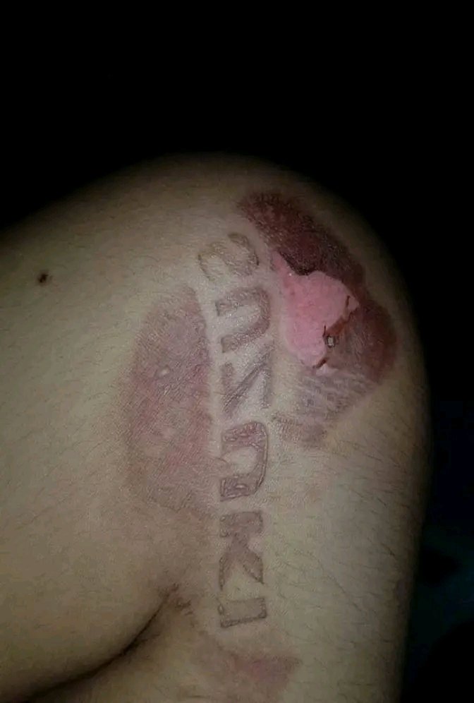 Suryananda100's tweet photo. ✨Treatment untuk luka bakar dan menghilangkan bekas luka

A thread https://t.co/9XGPvEOrYp