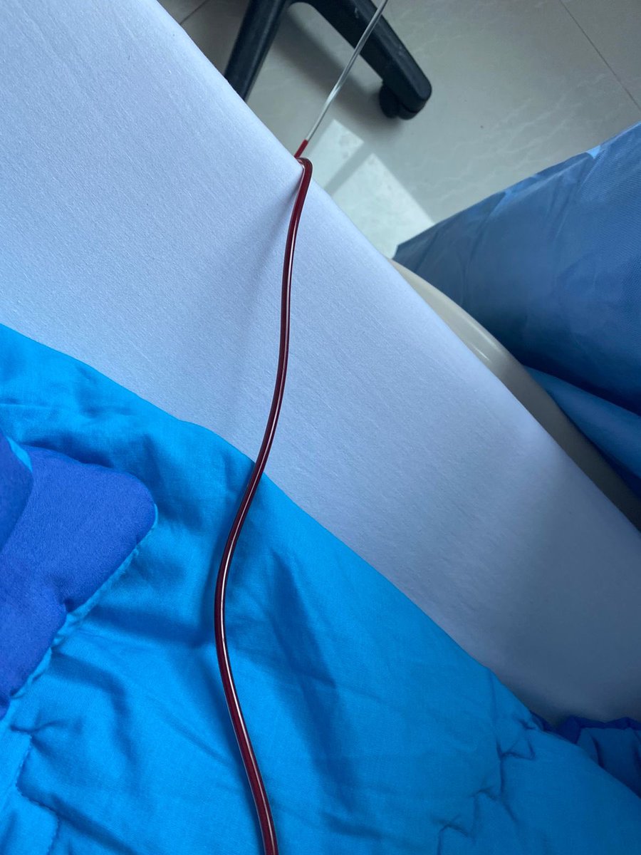 Masalah infus di tower 2 <a href="/RSMayapada/">rsmayapada</a> menjadi makanan tiap hari. Bengkak seperti foto yg di tweet sebelumnya. Atu foto yg ini, bbrp bulan lalu. Apakah hanya kami yg mengalami, atau ada yg juga mengalami gaes..