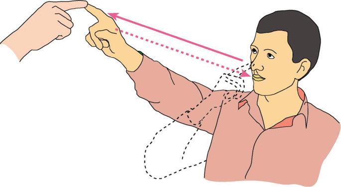 KrizLohman's tweet photo. 🧠Patrones de temblor 👋en la prueba dedo-nariz☝️👃
✅1. Normal
✅2. Cerebeloso (⬆️al final)
✅3. Parkinsónico (⬇️al final) 
✅4. Esencial (Zig-zag amplitud variable) https://t.co/b5e8JMf3Zg
