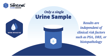 miRScientific's tweet photo. The miR Sentinel Prostate Cancer Test provides Prostate Cancer detection and classification, independent of clinical risk factors such as PSA, DRE, or histopathology. Check out https://t.co/Q6zZrc7R7r to learn more.
#prostatecancer #menshealth #urology https://t.co/Rs7DZkO1pM