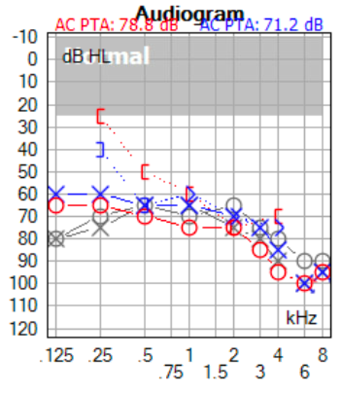 Chad Ruffin, MD 🦻🏻 tweet media