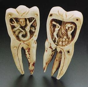 DentistryTfi's tweet photo. #toothart https://t.co/fel3WbbzTI