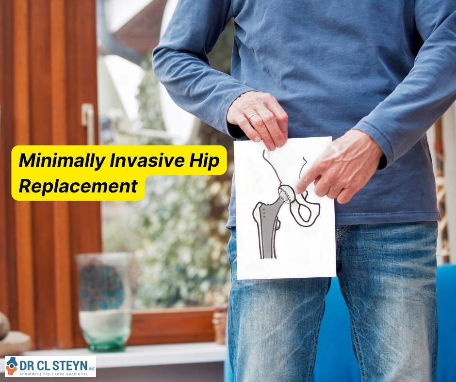 DrCLSteyn's tweet photo. Minimally Invasive Hip Replacement Pros and Cons Dr. CL Steyn Inc - Shoulder Surgeon - Cape Town https://t.co/ftJyVRV4Nq #drclsteyn #kneesurgery #orthopaedicsurgeon #shoulderdoc #shouldersurgery https://t.co/zNtMMbvyU0