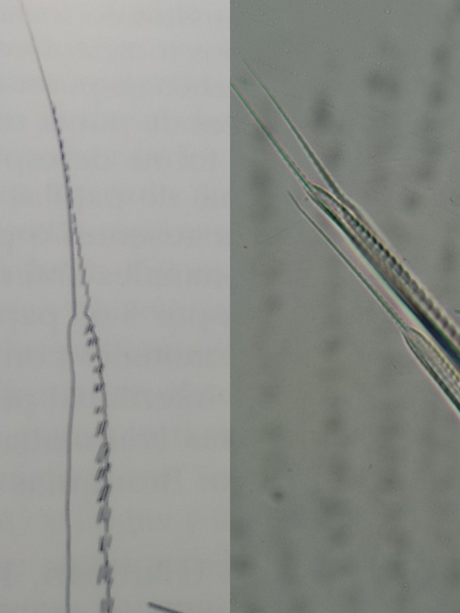 sgarciagmez's tweet photo. Neuroseda capilar crenulada en bayoneta del setígero 19 de Scoloplos typicus.
#espectacular #microesculturas #macrofauna #serbentos https://t.co/C19RCBBsgx