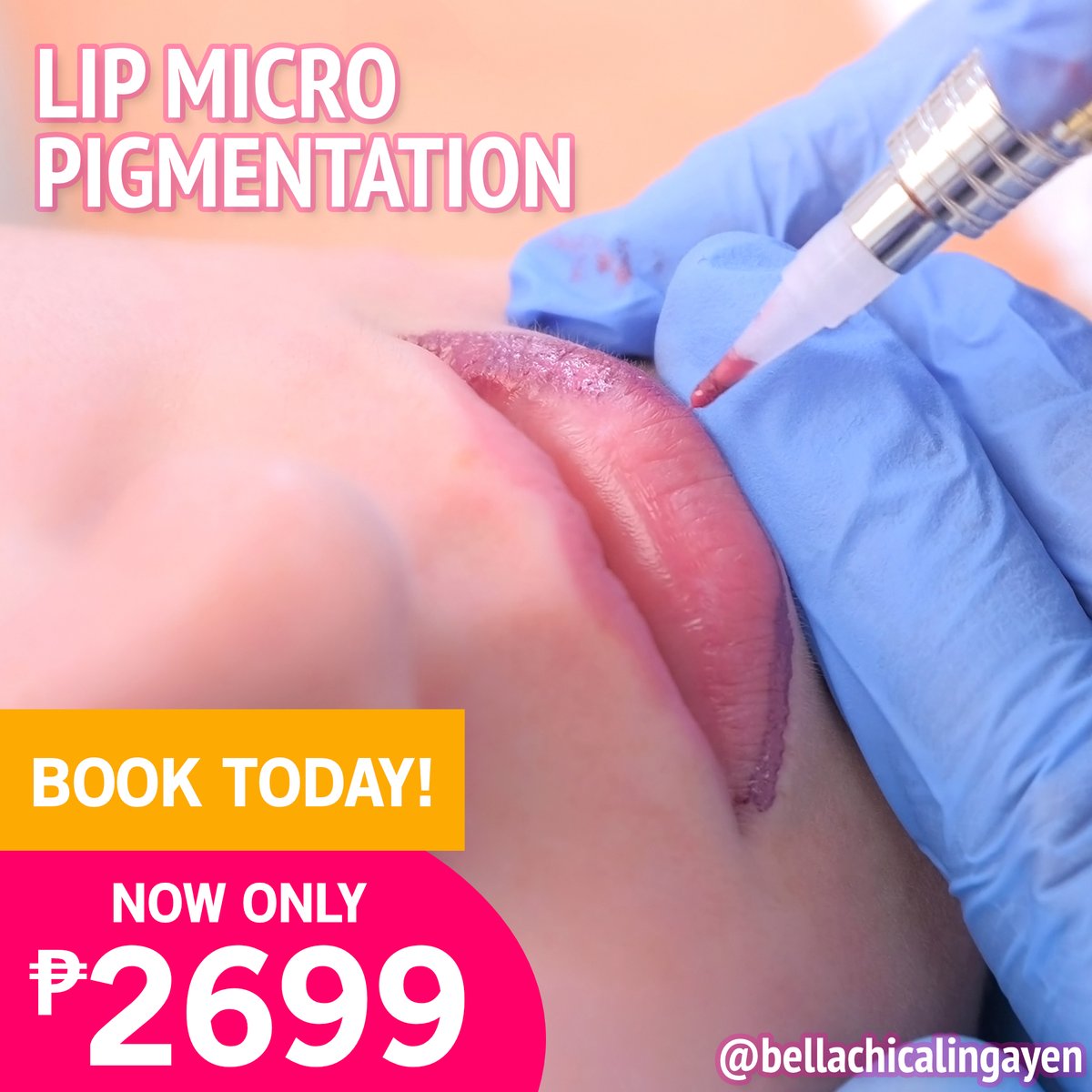 bclingayen's tweet photo. Are you tired of hiding your lips? We���ll make them look fuller and more attractive with lip micropigmentation. Promo ends on September 1st. Contact us today!

#lipmicropigmentation #liptattoo #liptattooing https://t.co/WrpvT38fdG