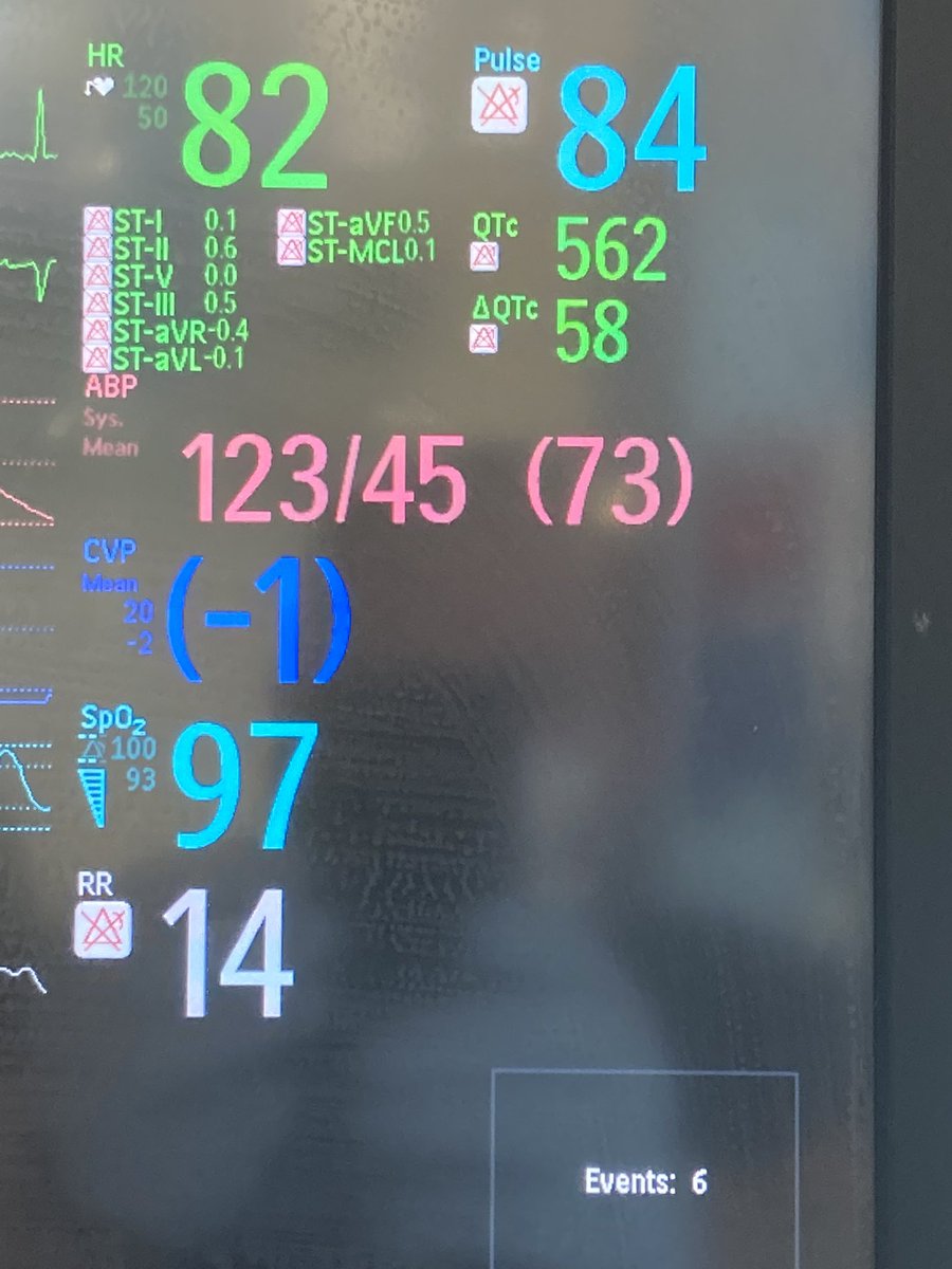 Christo30366089's tweet photo. The perfect blood pressure doesn’t exi……. #onlyintheICU #nurselife https://t.co/qvGFrjs8P7