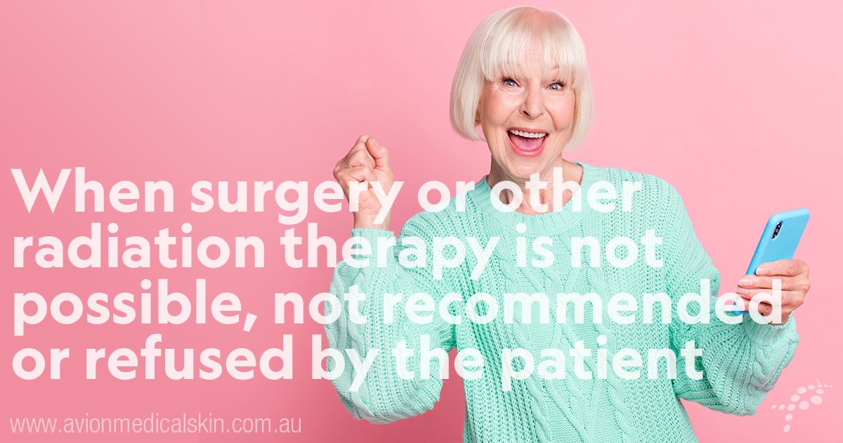 Avion Medical Skin Centres offers a painless* treatment option for patients with non-melanoma skin cancer.

Read more here: bit.ly/AMSkinCentres

*No reported pain[1,2]

References:
1. Cipriani C, et al. J Dermatolog Treat, 2020.
2. Sedda AF, et al. Clin Exp Dermatol, 2008.