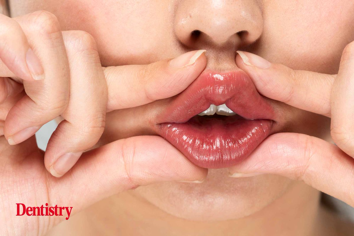 Dentistry's tweet image. Facial aesthetics – techniques to avoid the ‘trout pout’

Dr Teuta Berisha &amp;amp; Dr Benji Dhillon, of Define Clinic, talk through the importance of understanding &amp;amp; respecting aesthetic ideals when treating patients ⬇️ 

dentistry.co.uk/2022/08/18/fac…

#dentistry #troutpout #facialaesthetics