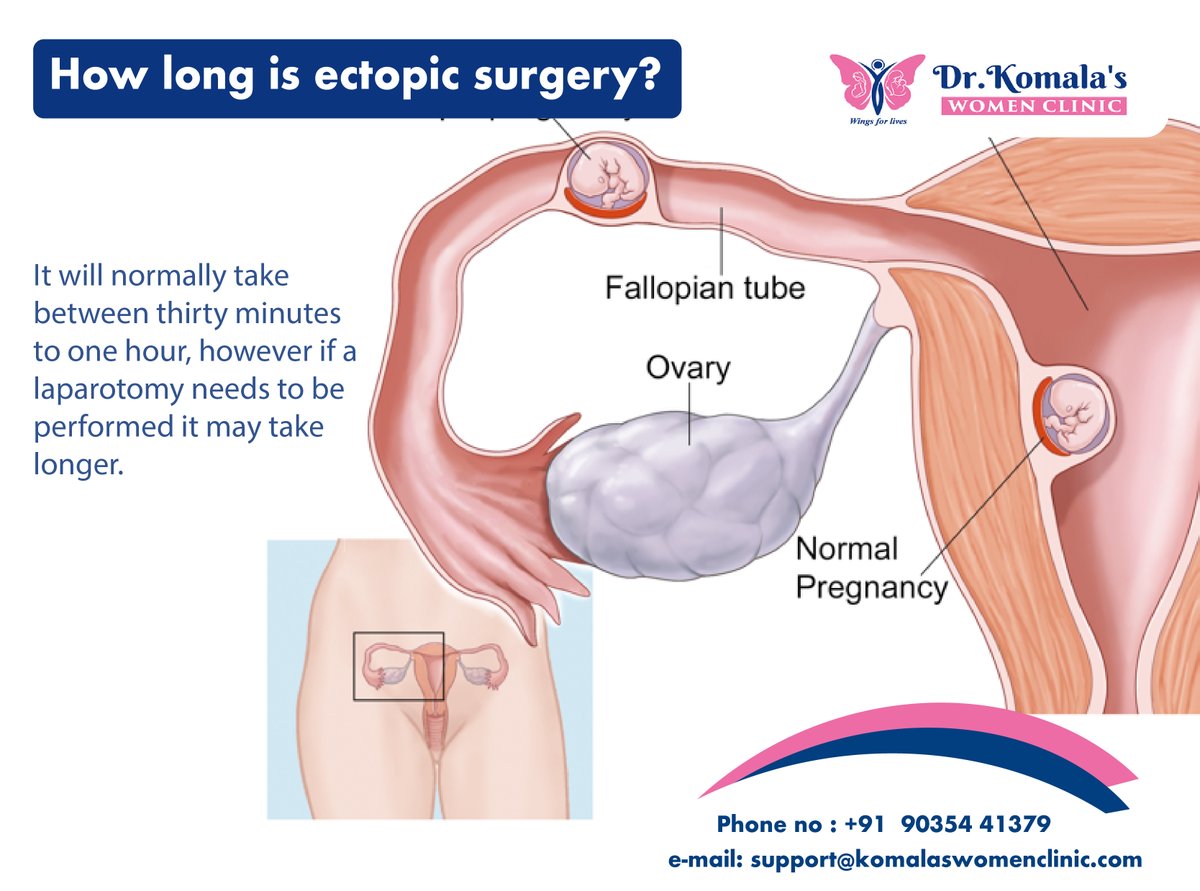 How long is ectopic surgery?

It will normally take between thirty minutes to one hour, however if a laparotomy needs to be performed it may take longer. 
You should return to the ward one to two hours following a short time in recovery.

#ectopicpregnancy #miscarriage #in