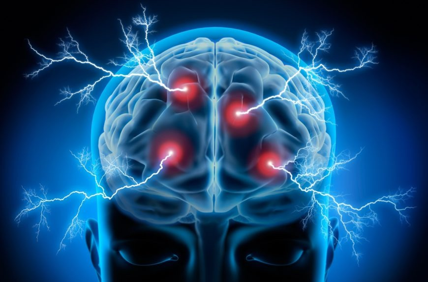 scholarjournals's tweet photo. Epilepsy is a central nervous system (neurological) illness characterised by abnormal brain activity, resulting in seizures or episodes of odd behaviour, feelings, and, in some cases, loss of awareness.
#epilepsy #neurologicaldisorder #mentalillness #lossofawareness https://t.co/vvNGUADehs
