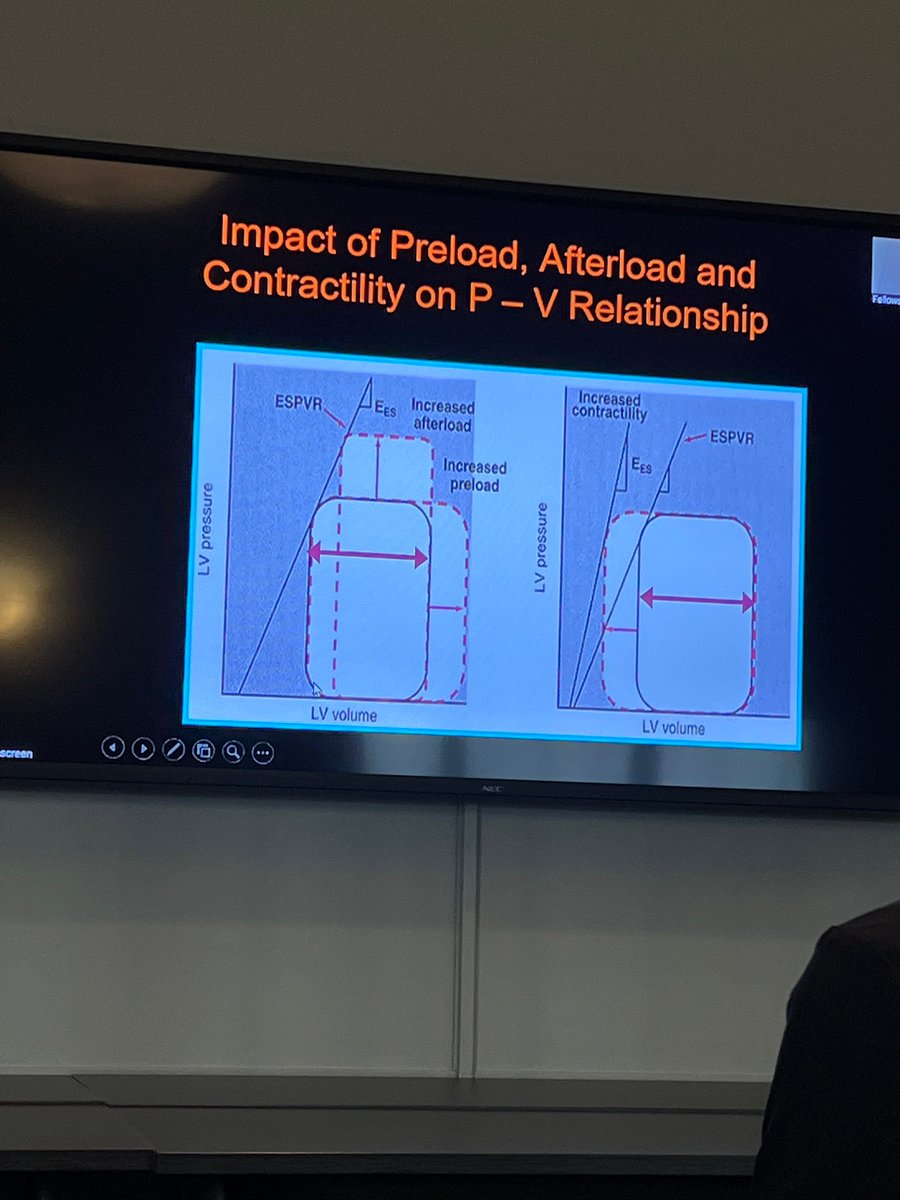 Jefferson Cardiology Fellows (@tjheartfellows) on Twitter photo Last but certainly not least - PV loop review.
"You can never spend enough time reviewing PV loops"
- <a href="/YevgeniyBr/">Yevgeniy Brailovsky DO MSc FACC</a>, probably
Stay tuned for a tweetorial on this topic... <a href="/jayamj94/">Jaya Janadhyala</a> <a href="/PSullivan000/">Patrick Sullivan</a> @IRajapreyar <a href="/gregorytgibson/">Greg Gibson</a> <a href="/EugeneStorozyn6/">Eugene Storozynsky MD, PhD</a> <a href="/DavidWienerMD/">David H. Wiener, MD</a> Last but certainly not least - PV loop review.
"You can never spend enough time reviewing PV loops"
- <a href="/YevgeniyBr/">Yevgeniy Brailovsky DO MSc FACC</a>, probably
Stay tuned for a tweetorial on this topic... <a href="/jayamj94/">Jaya Janadhyala</a> <a href="/PSullivan000/">Patrick Sullivan</a> @IRajapreyar <a href="/gregorytgibson/">Greg Gibson</a> <a href="/EugeneStorozyn6/">Eugene Storozynsky MD, PhD</a> <a href="/DavidWienerMD/">David H. Wiener, MD</a>