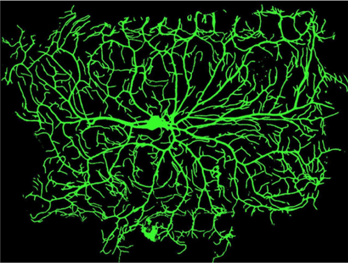 "Researchers in the Howard Lab published findings that revealed how dendritic tip growth drives  the branched structure of neurons." 

Read more here: mbb.yale.edu/news/howard-la…
