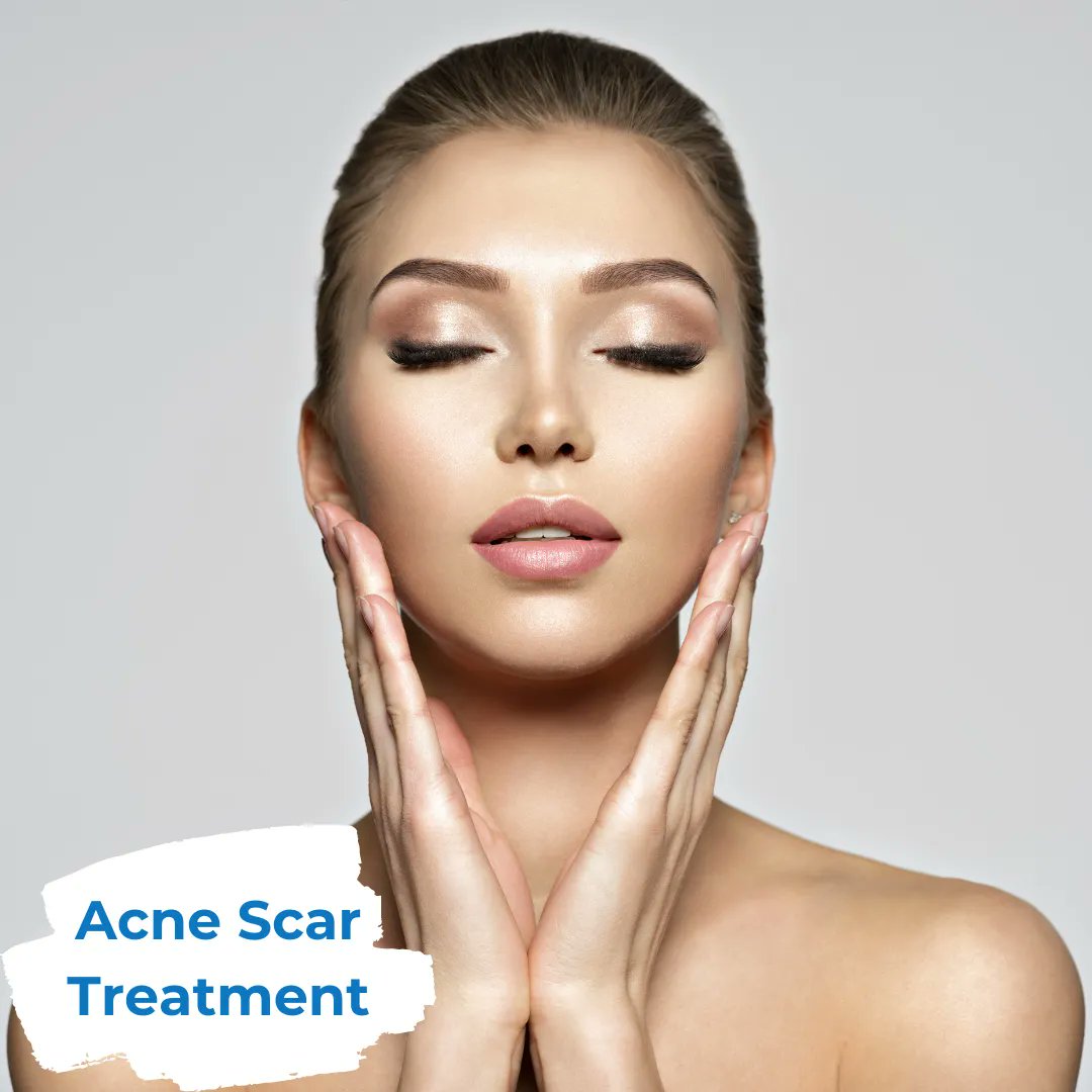 mbodycenter's tweet photo. Let us help you get rid of acne scar treatment and feel beautiful.
Call us today to schedule a consultation.
Tysons Corner (703) 740-8333
Richmond (804) 290-0909
#PlasticSurgery #MedSpa #Richmond #NorthernVirginia #VIPS #DrSundin #TysonsCorner #ViennaVA #WashingtonDC #beautiful https://t.co/RvZHDn6frF
