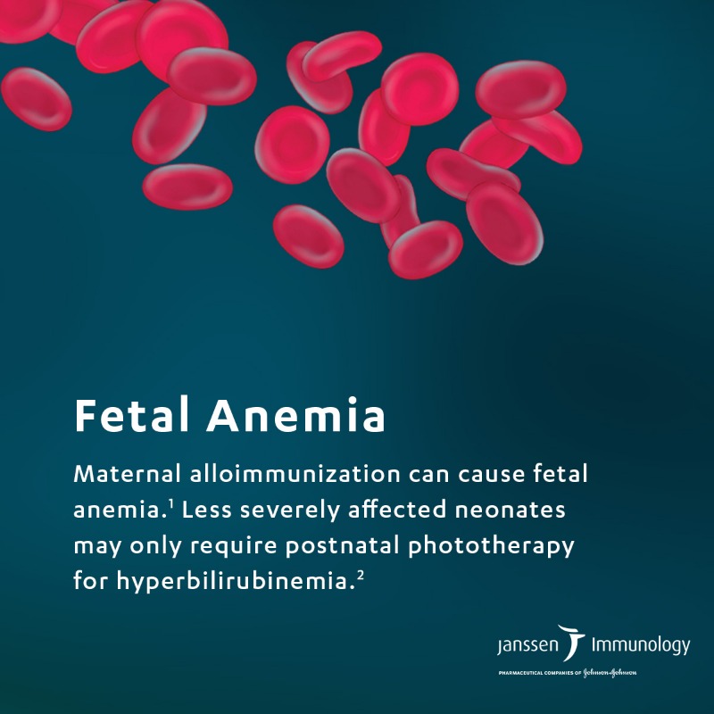 JNJInnovMed's tweet photo. Hemolytic disease of the fetus and newborn – or HDFN – is a rare maternal-fetal condition that occurs when a mother’s immune system attacks her unborn child’s blood cells. Slide to learn more about the impacts of this condition. #NFSAM