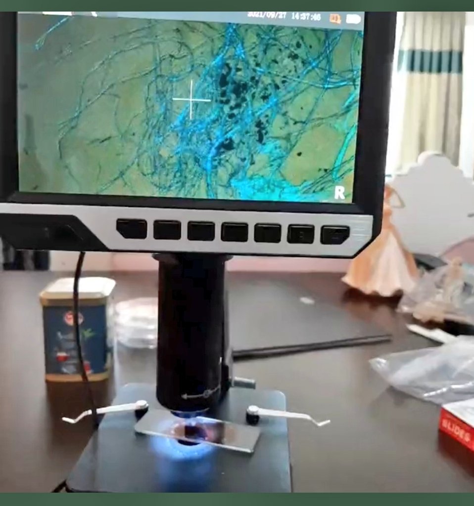 SerpilOzkan99's tweet photo. Aşıların yan etkisi yoktur.  

Planlanan sonucu vardır. 

Şeytani plan,Time dergisinde saniye saniye 2030'dan geri sayıyor.  

Siz hâlâ Hacamat olmadınız mı? 

Madde Karbon kökenli, siz bir şey yok sanıyorsunuz. Graphene Fullerenler %70 sınırına gelince herşey birdenbire olacak. https://t.co/y22cFrQ6Gv