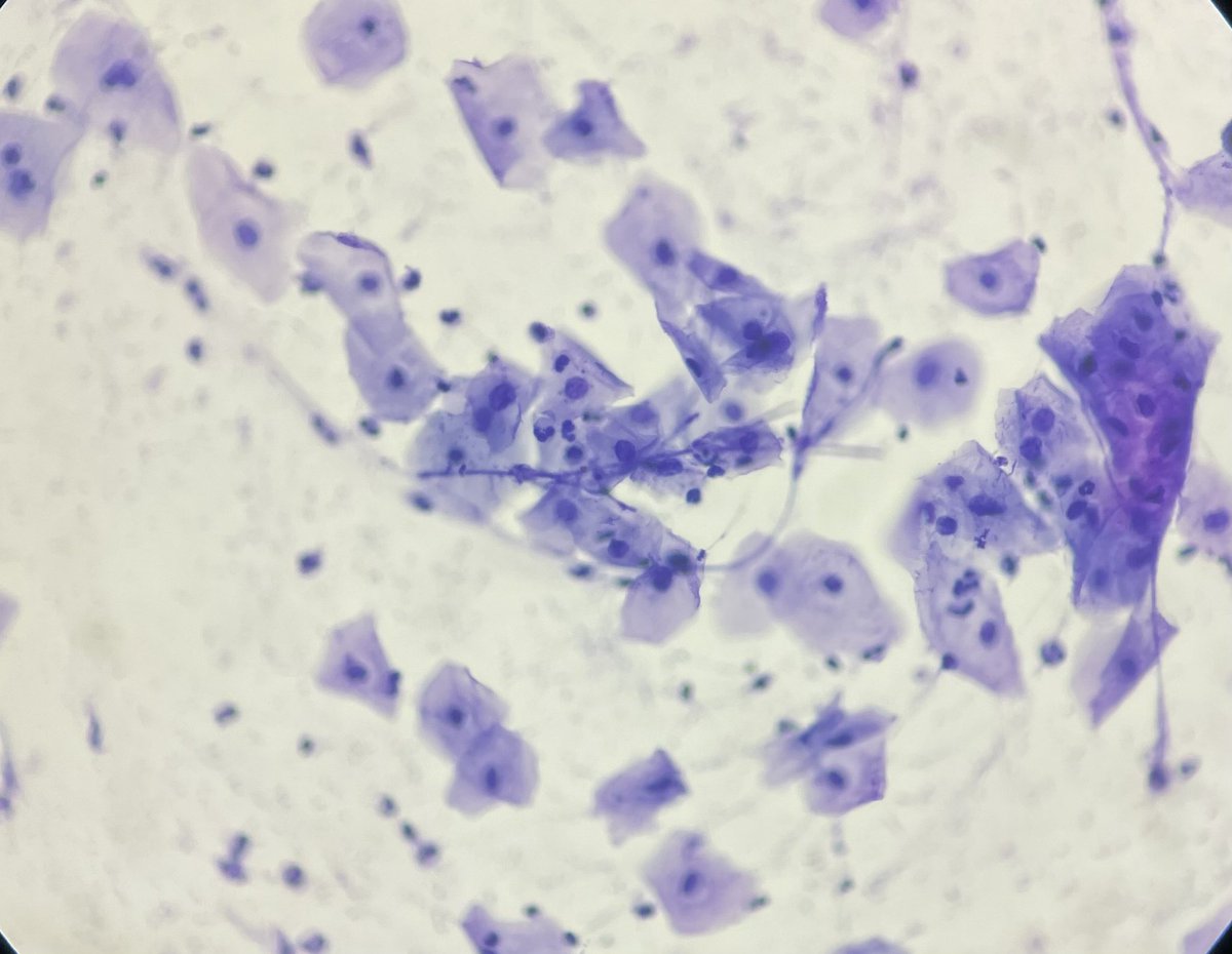 #papsmear

#shishkebab or candida 🤔