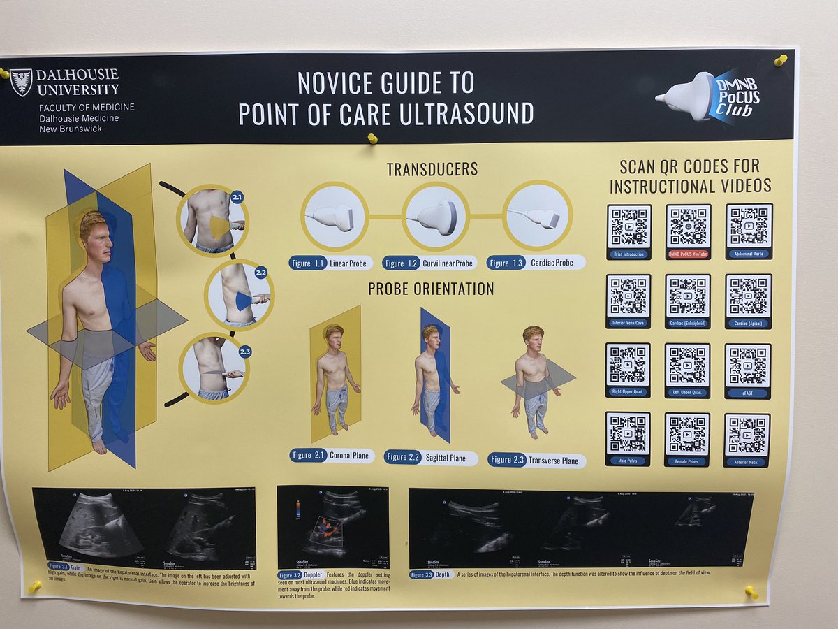 Had fun teaching our <a href="/DalMedNB/">DalMedNB</a> med students eFAST this morning <a href="/DmnbPocus/">DMNB PoCUS Club</a> #POCUS