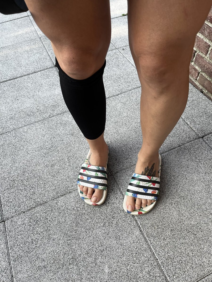 kimskinskipster's tweet photo. Been doet nog steeds zeer. Kneuzing en schaafwond. Of ik toch ga #kickboksen? Jazeker. Een afgeknipte legging om mn schaafwond te beschermen tegen de sluiting van mn scheenbeschermer en gaan. #NoPainNoGain #boxingismylife https://t.co/2GVDsnQ8AD