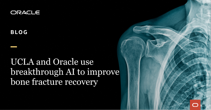 clholzer's tweet photo. See how the team at @UCLAHealth are utilizing resources from @OracleCloud and @OracleResearch to build #MachineLearning (#ML) models for improving bone fracture recovery. Read more: https://t.co/lc7SBDu6r8 https://t.co/z3wPJHzQyT
