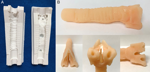 VUMC Otolaryngology–Head and Neck Surgery (@vanderbiltent) on Twitter photo Dr. <a href="/jasonparkmdphd/">Jason Park</a> is co-author of this study that demonstrates how use of a 3D printed laryngeal suturing simulator improves confidence & objective surgical skills in surgical training for endoscopic laryngeal cleft repair, an advanced surgical skill: onlinelibrary.wiley.com/doi/10.1002/la… Dr. <a href="/jasonparkmdphd/">Jason Park</a> is co-author of this study that demonstrates how use of a 3D printed laryngeal suturing simulator improves confidence & objective surgical skills in surgical training for endoscopic laryngeal cleft repair, an advanced surgical skill: onlinelibrary.wiley.com/doi/10.1002/la…