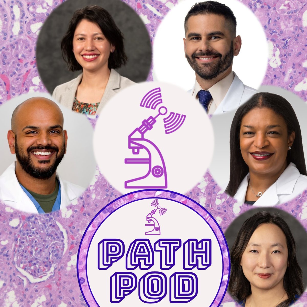 The PathPod Podcast (@pathpod) on Twitter photo โจNEW #PathPod Around the Scope- Renal Pathology!
Host <a href="/Sara_Jiang/">Xiaoyin "Sara" Jiang, MD (She/Her)</a> speaks w/
<a href="/BCRenalPath/">Mei Lin Bissonnette MD PhD FRCPC</a>, <a href="/theglasspusher/">Carla Ellis MD, MS</a>, @AlcinoGama, & @vighnesh_w
What's new in #RenalPath? How is @RenalPathSoc supporting DEI efforts? What is two-handed fly fishing?
๐LISTEN NOW: pathpod.podbean.com โจNEW #PathPod Around the Scope- Renal Pathology!
Host <a href="/Sara_Jiang/">Xiaoyin "Sara" Jiang, MD (She/Her)</a> speaks w/
<a href="/BCRenalPath/">Mei Lin Bissonnette MD PhD FRCPC</a>, <a href="/theglasspusher/">Carla Ellis MD, MS</a>, @AlcinoGama, & @vighnesh_w
What's new in #RenalPath? How is @RenalPathSoc supporting DEI efforts? What is two-handed fly fishing?
๐LISTEN NOW: pathpod.podbean.com