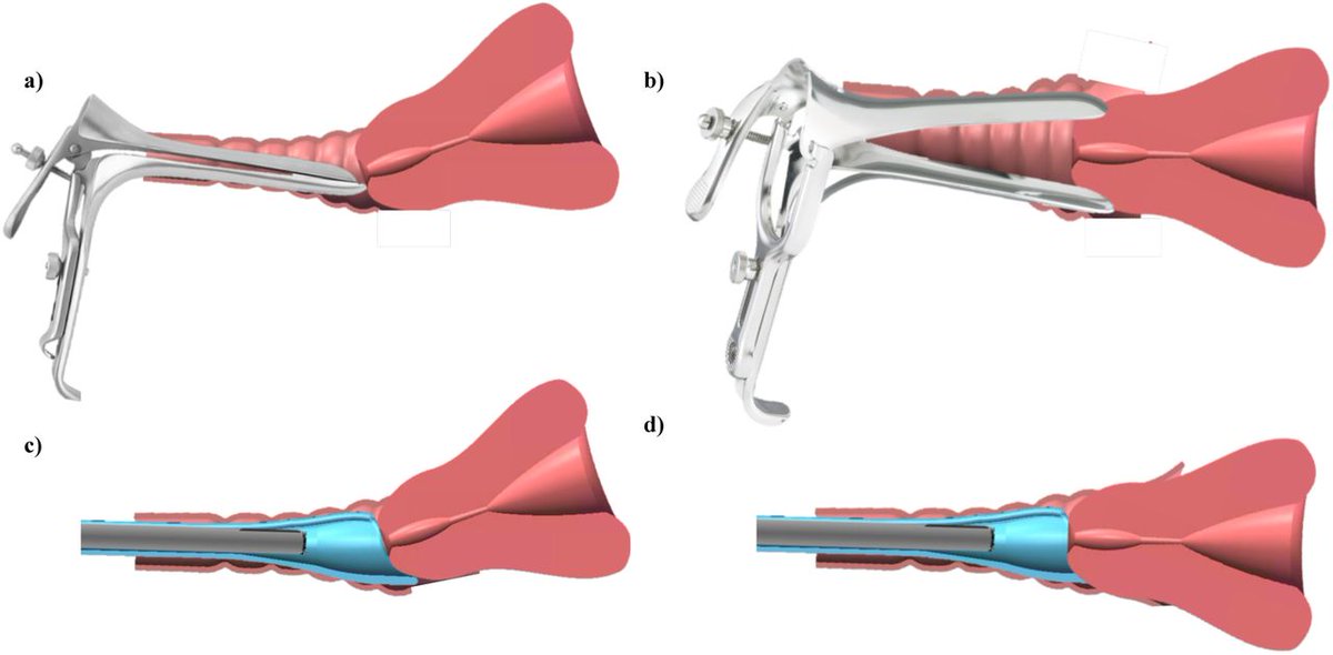 ChelseeJonesART's tweet photo. #DidYouKnow there is a device out there that replaces the #speculum? #why is it not in hospitals yet? #womanshealth #cervicalhealth #gynocology #womansrights https://t.co/5rFxrGp1IX