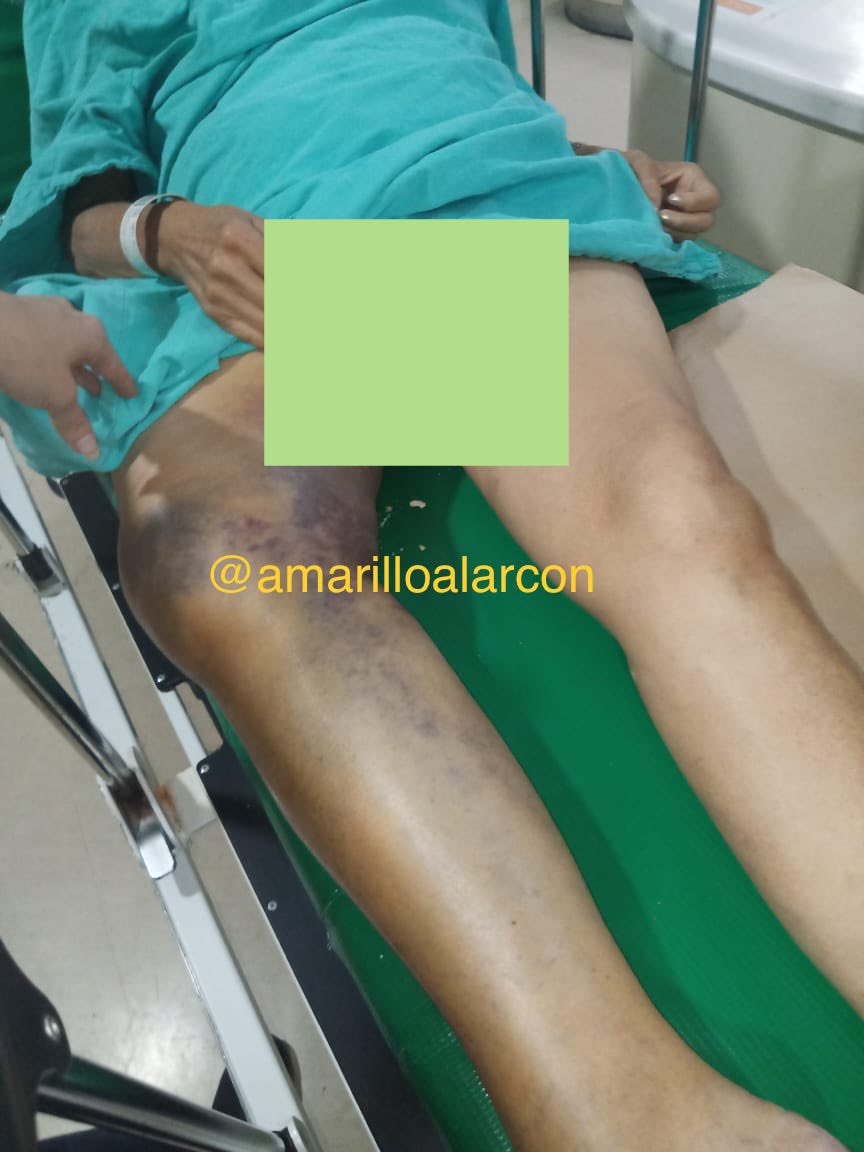 amarilloalarcon's tweet photo. Cobran rentas DE SUS PADRES y se las guardan, cobran pAgos de pensión y se los quedan… los sonaban con vocabulario soez y agresivo, les recuerdan a sus padres reiteradamente que pronto van a morir
@FiscaliaCDMX 
LO PEOR: en casi 3 años de PANDEMIA NO los han llevado a VACUNAR https://t.co/N36qO5VkJz