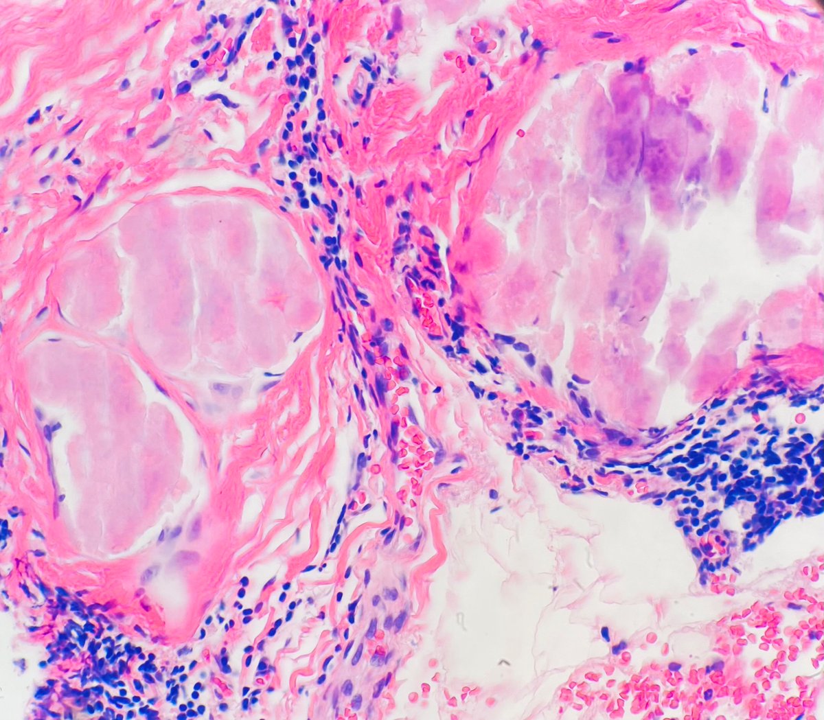 Hansini Laharwani tweet media