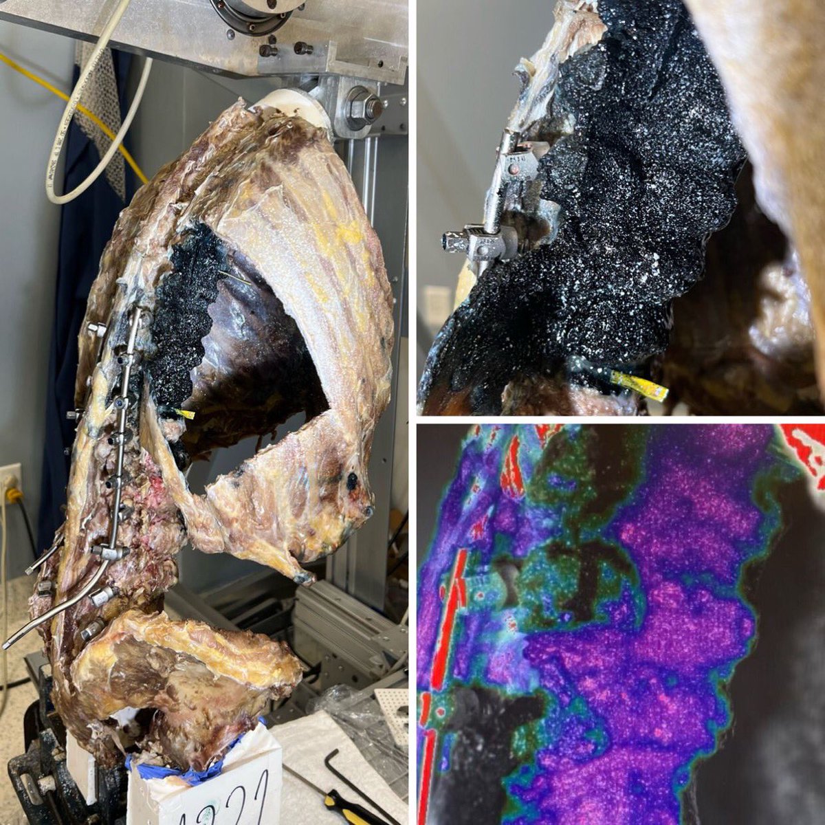 PJK/PJF Proximal Junctional Kyphosis (PJK) and Failure (PJF) is one of our biggest challenges in adult spinal deformity surgery. At the Sonntag Spine Center Biomechanics Laboratory, we are using our robotic-assisted mounting apparatus to test strain and stress using (DIC).