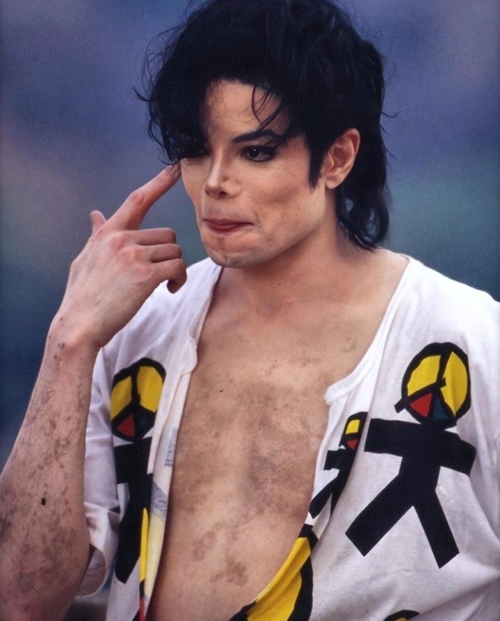 paidocirilo's tweet photo. esta é Barbarhat Sueyassu, uma influencer brasileira que possui a mesma doença que fez Michael Jackson  ''mudar de cor'', o vitiligo universal. 
Barbahat sempre deixou claro o quanto Michael foi importante para a sua aceitação, e o vê como um grande exemplo! https://t.co/1cH75DPSwH