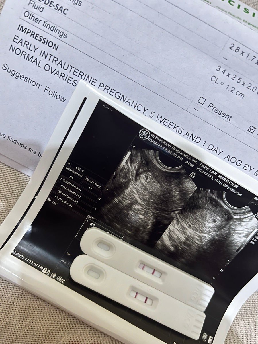 Fbllrmrchim's tweet photo. Weloveyou so, so much and we missyou so much our Little Angel Baby. 👼🏻🥺😭 

#TwomonthsinMamasTummby 🙏🏼👼🏻
#GratefulBlessed 🤍🤍 https://t.co/5NLVkI422O