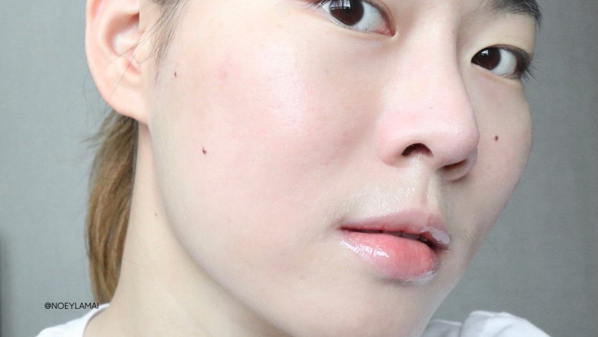 โฟมล้างหน้ายูเซอริน Pro Acne Soft Cleansing Foam อันนี้ ใช้ดีมากกกๆๆ เราเป็นคนผิวแพ้ง่าย สิวขึ้นง่ายด้วย ตั้งแต่เปลี่ยนมาใช้ตัวนี้ คือสิวลดลง สิวใหม่ไม่ค่อยขึ้น หน้ามันน้อยลง คือเริ่ดสำหรับผิวเป็นสิว แพ้ง่ายแบบเรา