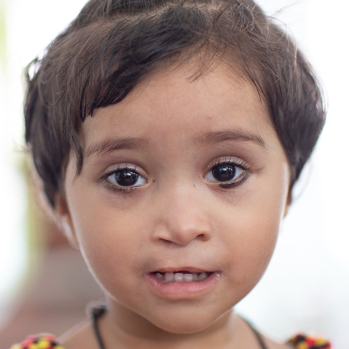 OpSmileIrl's tweet photo. Mum Tasheen blamed herself for daughter Dilfa’s #cleft. She’d never seen or heard of anyone else with a cleft. Then she met volunteers from our cleft centre in #Durgapur, India, not far from where the family lived.  Just look at her transformation! ❤️ #SharingSmiles #CleftCare https://t.co/RFjeBjOnUO