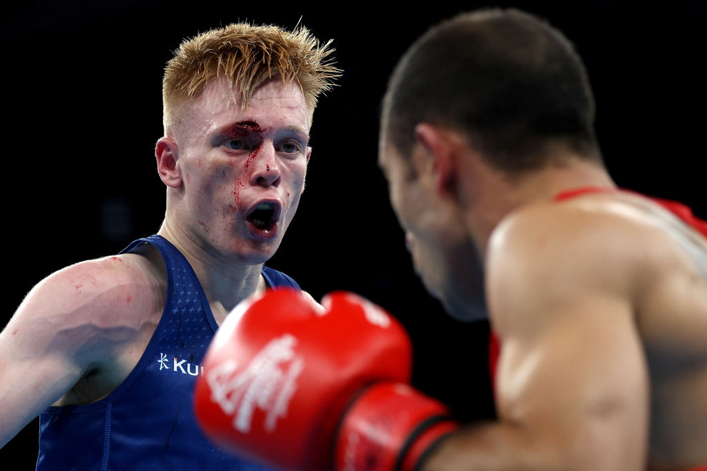 GB Boxing (@gbboxing) on Twitter photo ๐๐ผ๐๐๐๐๐! โ๏ธ
<a href="/KiaranMac/">Kiaran Macdonald</a> | <a href="/GettyImages/">Getty Images</a> ๐๐ผ๐๐๐๐๐! โ๏ธ
<a href="/KiaranMac/">Kiaran Macdonald</a> | <a href="/GettyImages/">Getty Images</a>