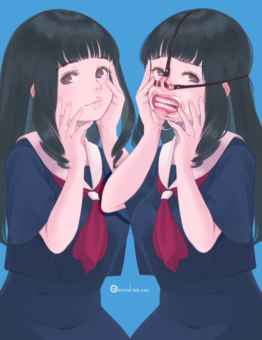 鼻フック練習3 アングルワイダー(開口器) 