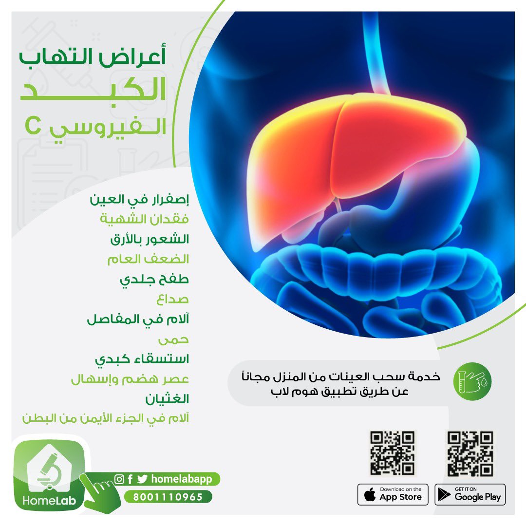 مصدع ؟ 😔
تعبان وتحس عيونك فيها اصفرار 
تعرف على أهم أعراض التهاب الكبد  
وخليك حريص واطلب التحليل  

مع #هوم_لاب نخدمك وأنت بمكانك 💉 

حمل التطبيق آلان 📲
 
onelink.to/4av4pf