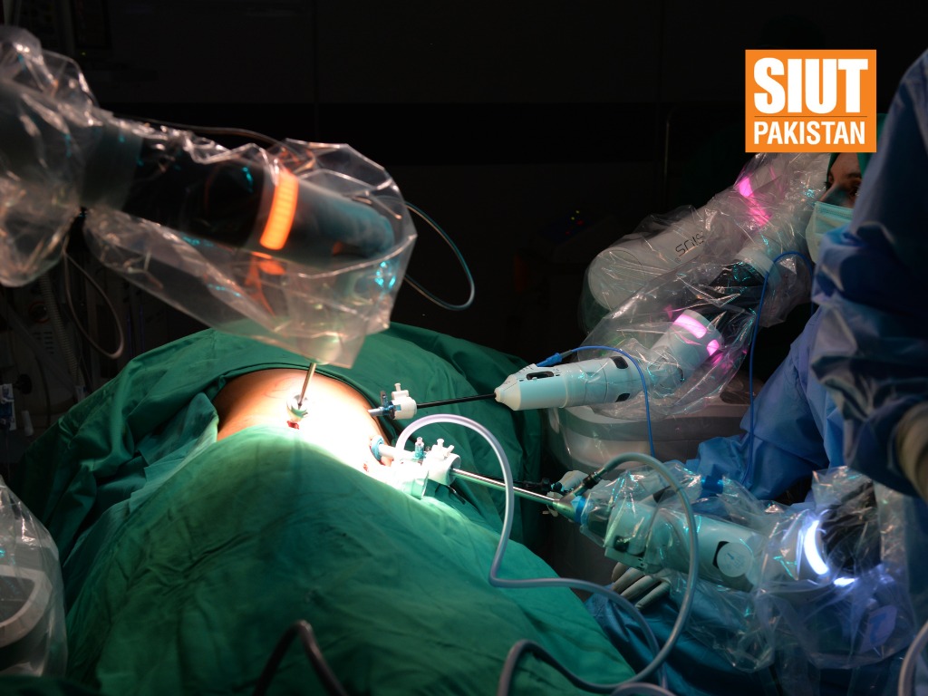 SIUT Pakistan (@siutorg) on Twitter photo 65 Male with TCC Bladder.
Negative Margins
No conversion
Good outcome
Centre of excellence!
#SIUT #CentreOfExcellence #RoboticSurgery #urology
<a href="/rehanmohsin123/">Rehan Mohsin</a>
<a href="/AsadShahzadHas1/">Asad Shahzad Hasan</a>
<a href="/dr_hhq/">harlee</a>
<a href="/Khurshidguru/">Khurshid A. Guru</a>
<a href="/CMRsurgical/">CMR Surgical</a>
<a href="/JUrology/">Journal of Urology</a>
<a href="/JRobotSurg/">Journal of Robotic Surgery</a>
<a href="/BJUIjournal/">BJU International</a>
<a href="/irizvimd/">Irfan Rizvi MD, FRCS(Eng), FACS, FASCRS</a> 65 Male with TCC Bladder.
Negative Margins
No conversion
Good outcome
Centre of excellence!
#SIUT #CentreOfExcellence #RoboticSurgery #urology
<a href="/rehanmohsin123/">Rehan Mohsin</a>
<a href="/AsadShahzadHas1/">Asad Shahzad Hasan</a>
<a href="/dr_hhq/">harlee</a>
<a href="/Khurshidguru/">Khurshid A. Guru</a>
<a href="/CMRsurgical/">CMR Surgical</a>
<a href="/JUrology/">Journal of Urology</a>
<a href="/JRobotSurg/">Journal of Robotic Surgery</a>
<a href="/BJUIjournal/">BJU International</a>
<a href="/irizvimd/">Irfan Rizvi MD, FRCS(Eng), FACS, FASCRS</a>