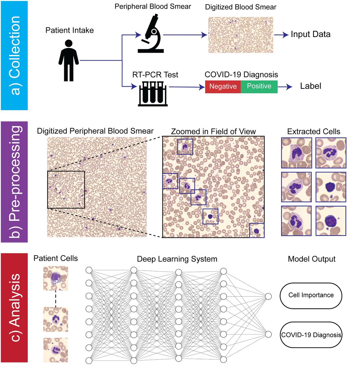 PLOS Digital Health (@plosdigihealth) on Twitter photo 📢📰Cooke et al present a multiple instance learning approach for detecting COVID-19 in peripheral blood smears 🩸 Read more about it here: dx.plos.org/10.1371/journa… #DigitalHealth #MachineLearning <a href="/HorstmeyerLab/">Computational Optics Lab (Roarke Horstmeyer)</a> 📢📰Cooke et al present a multiple instance learning approach for detecting COVID-19 in peripheral blood smears 🩸 Read more about it here: dx.plos.org/10.1371/journa… #DigitalHealth #MachineLearning <a href="/HorstmeyerLab/">Computational Optics Lab (Roarke Horstmeyer)</a>