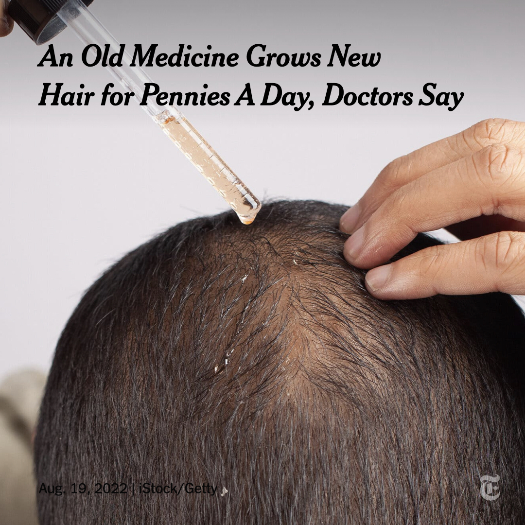 Eli Cohen on Twitter "RT nytimes An old and wellknown hairloss