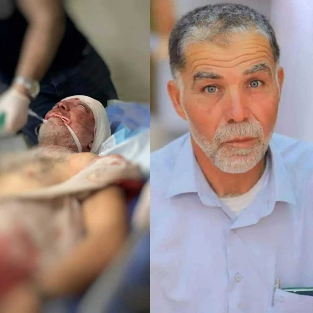 AyaIsleemEn's tweet image. 🇵🇸#Palestine | The Palestinian Salah Sawafta (58) has died of his wounds sustained by the Israeli occupation that raided Tubas city.