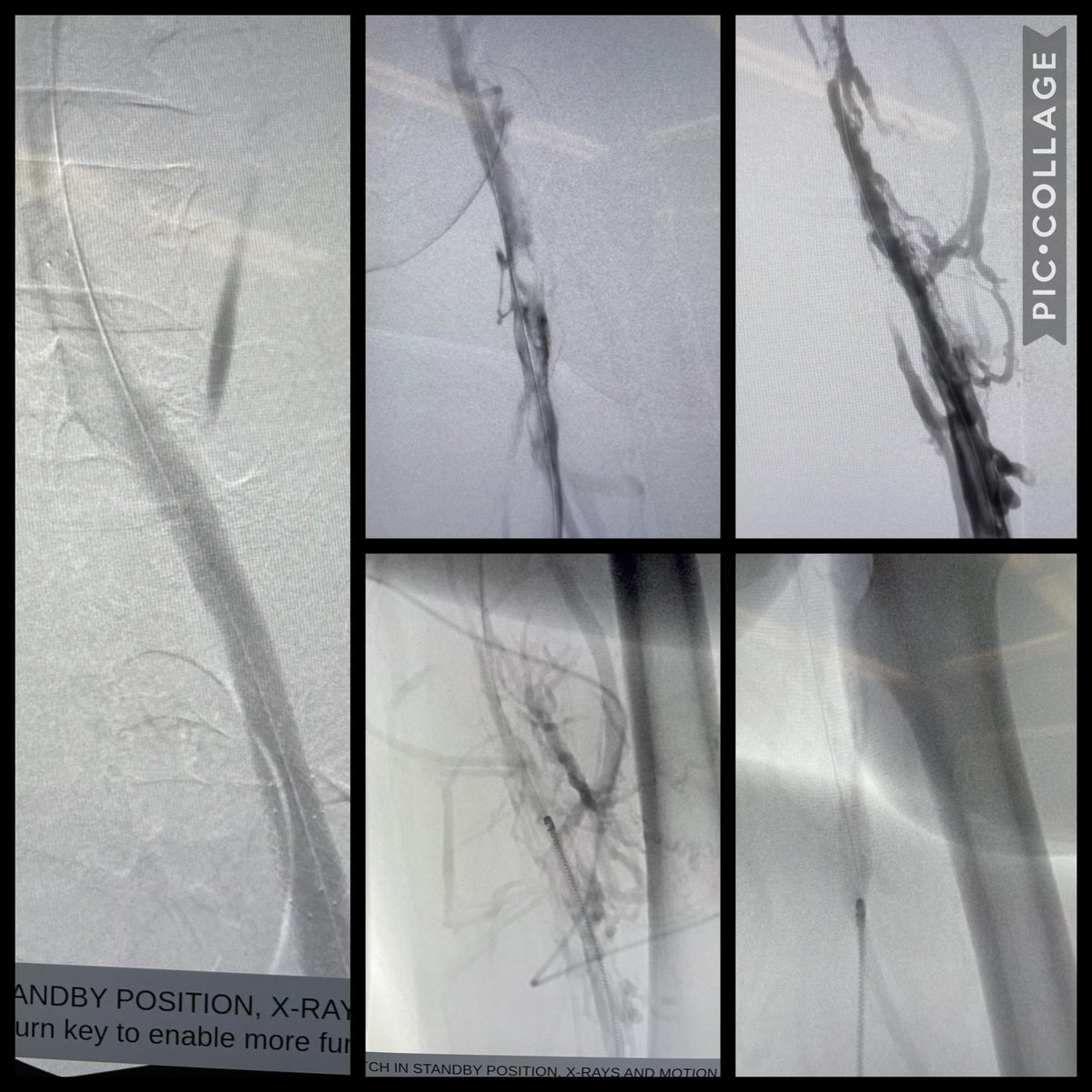 jsilpemd tweet media