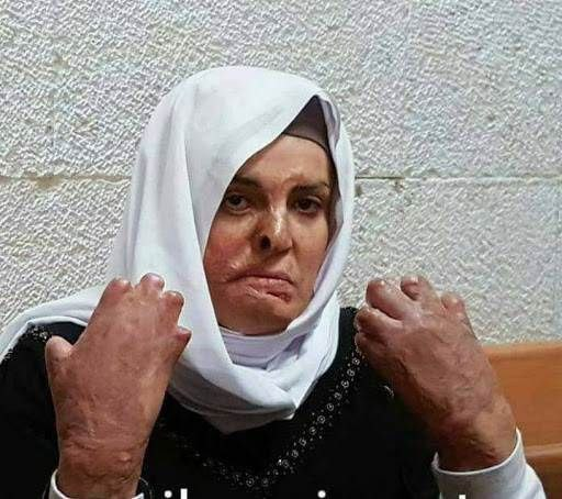 SaraReyi's tweet photo. This women, 👇is one of many victims of IOF, the world's most moral army.
#جمعة_الحریة۱۰
#الامهات_الاسيرات https://t.co/2V4Lu1a9z8